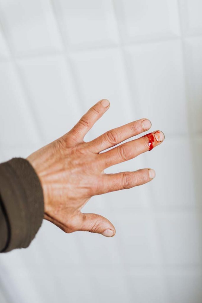 Vitamin K is possibly safe when taken by mouth with the right dosages.